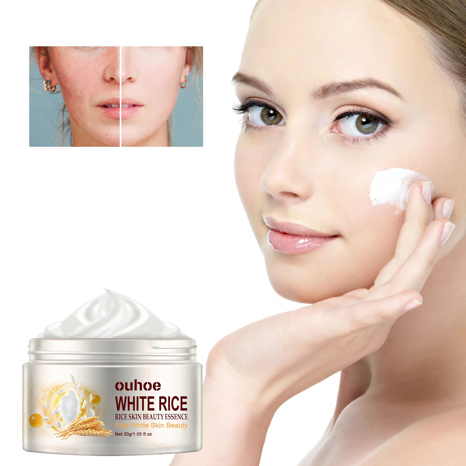 Creme Facial Antirrugas de Arroz – Tratamento para Acne, Melasma e Clareamento - PAGUE 1 LEVE 3