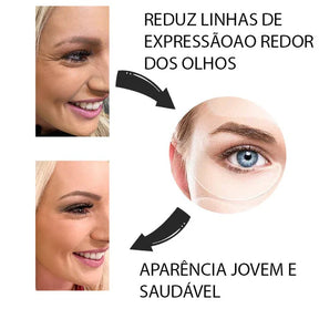 Nature Botox - Livre de rugas e linhas de expressões